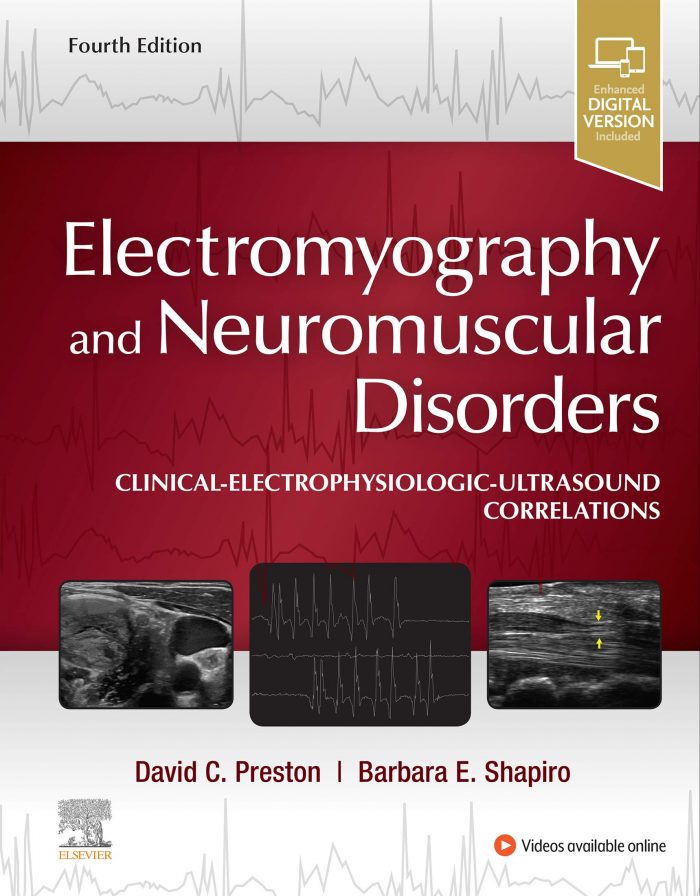 Electromyography and Neuromuscular Disorders: Clinical-Electrophysiologic-Ultrasound Correlations