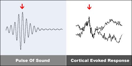  /></p><p> The picture above shows you how the brain reacts to the pulses of sound. When the brain is presented with a rhythmic stimulus, the rhythm is reproduced in the brain in the form of electrical impulses. <strong>If the rhythm becomes fast and consistent enough, the brain responds by synchronizing its own electric cycles to the same rhythm. </strong>This is called Frequency Following Response (FFR).</p><p>The graph below shows you how brain synchronizes to the rhythm:</p><p><img src=