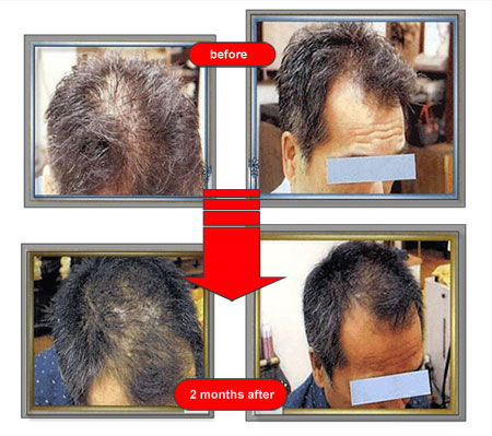 before and after
