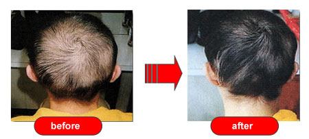 before and after
