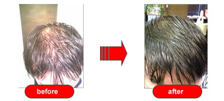 before and after